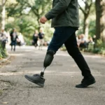 Person walking outdoors with a prosthetic leg after an amputation injury in Ontario